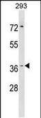 Hydroxypyruvate Isomerase (Putative) antibody, PA5-48849, Invitrogen Antibodies, Western Blot image 