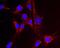 Nicotinamide Nucleotide Transhydrogenase antibody, ab110352, Abcam, Immunofluorescence image 