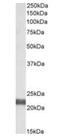 Ubiquitin Conjugating Enzyme E2 F (Putative) antibody, orb22543, Biorbyt, Western Blot image 