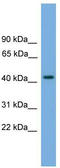 Acyl-CoA Binding Domain Containing 7 antibody, TA335984, Origene, Western Blot image 