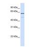 Methyltransferase Like 16 antibody, NBP1-79255, Novus Biologicals, Western Blot image 