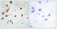 Adenosine Deaminase RNA Specific antibody, abx013542, Abbexa, Western Blot image 