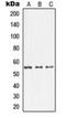 Rho GDP Dissociation Inhibitor Alpha antibody, orb213976, Biorbyt, Western Blot image 