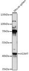 Arsenite Methyltransferase antibody, 16-452, ProSci, Western Blot image 