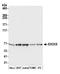 Exocyst Complex Component 5 antibody, A305-546A, Bethyl Labs, Western Blot image 