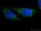 Solute Carrier Family 25 Member 1 antibody, 15235-1-AP, Proteintech Group, Immunofluorescence image 