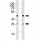 Sirtuin 3 antibody, F49519-0.4ML, NSJ Bioreagents, Western Blot image 