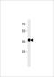 Matrix AAA Peptidase Interacting Protein 1 antibody, LS-C204002, Lifespan Biosciences, Western Blot image 