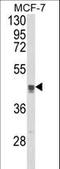 Trans-Golgi network integral membrane protein 2 antibody, LS-C161840, Lifespan Biosciences, Western Blot image 
