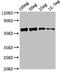 ATP Binding Cassette Subfamily D Member 2 antibody, orb51386, Biorbyt, Western Blot image 