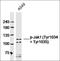 Janus Kinase 1 antibody, orb6249, Biorbyt, Western Blot image 