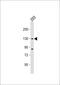 DExH-Box Helicase 30 antibody, 58-959, ProSci, Western Blot image 