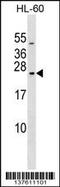RAB20, Member RAS Oncogene Family antibody, 59-310, ProSci, Western Blot image 