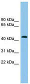 Actin Related Protein 1B antibody, TA340073, Origene, Western Blot image 