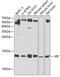 Vasoactive Intestinal Peptide antibody, GTX64386, GeneTex, Western Blot image 