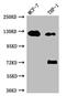 Androgen Receptor antibody, CSB-RA217661A0HU, Cusabio, Western Blot image 