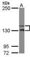 TAO Kinase 2 antibody, NBP2-20562, Novus Biologicals, Western Blot image 