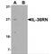 Interleukin 36 Receptor Antagonist antibody, MBS153357, MyBioSource, Western Blot image 