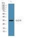 C-Type Lectin Domain Containing 10A antibody, A09933-1, Boster Biological Technology, Western Blot image 