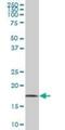 Guided Entry Of Tail-Anchored Proteins Factor 1 antibody, H00007485-M05, Novus Biologicals, Western Blot image 