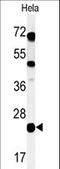 Chromosome 16 Open Reading Frame 54 antibody, LS-C166979, Lifespan Biosciences, Western Blot image 