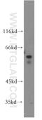 Matrix Metallopeptidase 19 antibody, 14244-1-AP, Proteintech Group, Western Blot image 