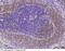 CD38 Molecule antibody, 80229-T26, Sino Biological, Immunohistochemistry paraffin image 