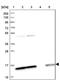 Small Nuclear Ribonucleoprotein D2 Polypeptide antibody, PA5-59572, Invitrogen Antibodies, Western Blot image 