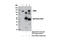 Mitogen-Activated Protein Kinase 7 antibody, 12950S, Cell Signaling Technology, Immunoprecipitation image 