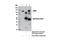 Bmk1 antibody, 12950S, Cell Signaling Technology, Immunoprecipitation image 