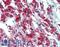 Interleukin 23 Subunit Alpha antibody, LS-B3708, Lifespan Biosciences, Immunohistochemistry frozen image 
