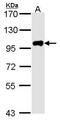 Calpain 3 antibody, GTX102500, GeneTex, Western Blot image 
