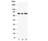 GLI Family Zinc Finger 3 antibody, R30859, NSJ Bioreagents, Western Blot image 