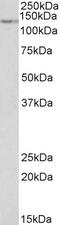 ADAM Metallopeptidase Domain 12 antibody, 43-502, ProSci, Western Blot image 