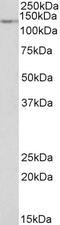 Disintegrin and metalloproteinase domain-containing protein 12 antibody, 43-502, ProSci, Western Blot image 