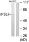 Eukaryotic Translation Initiation Factor 3 Subunit L antibody, LS-C119334, Lifespan Biosciences, Western Blot image 
