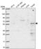 Pseudouridine Synthase 3 antibody, NBP2-55852, Novus Biologicals, Western Blot image 