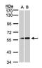 Serpin Family G Member 1 antibody, LS-C185698, Lifespan Biosciences, Western Blot image 