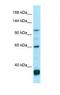 Phosphodiesterase 6C antibody, NBP1-98502, Novus Biologicals, Western Blot image 