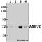 Zeta Chain Of T Cell Receptor Associated Protein Kinase 70 antibody, A00754T286, Boster Biological Technology, Western Blot image 