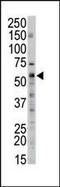 Serine Palmitoyltransferase Long Chain Base Subunit 2 antibody, PA5-12219, Invitrogen Antibodies, Western Blot image 