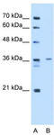 Tropomyosin 2 antibody, TA346576, Origene, Western Blot image 