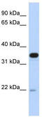 Phosphatidylinositol Transfer Protein Beta antibody, TA334455, Origene, Western Blot image 