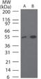 Terminal Nucleotidyltransferase 4A antibody, GTX13662, GeneTex, Western Blot image 