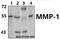 Matrix Metallopeptidase 1 antibody, A00733-2, Boster Biological Technology, Western Blot image 