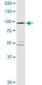 Glycogen Phosphorylase L antibody, H00005836-D01P, Novus Biologicals, Western Blot image 