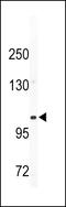 Integrin Subunit Alpha 5 antibody, 61-569, ProSci, Western Blot image 