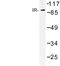 Insulin Receptor antibody, LS-C177319, Lifespan Biosciences, Western Blot image 