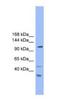 StAR Related Lipid Transfer Domain Containing 8 antibody, NBP1-69098, Novus Biologicals, Western Blot image 