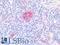 Nerve Growth Factor Receptor antibody, LS-B11013, Lifespan Biosciences, Immunohistochemistry paraffin image 